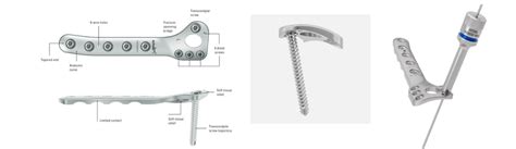 Distal Humeral Fracture System TribeVet