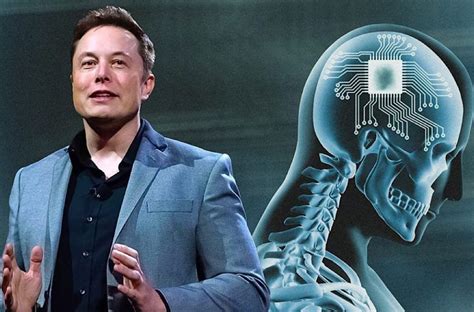 Elon Musk Logra Implantar Un Chip En El Cerebro Frecuencia Zero Fm