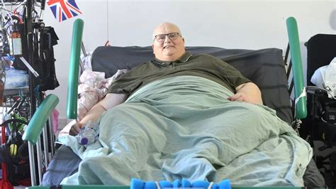The Worlds Fattest Person A Testament To Medical Extremes Human Endurance And Social Complexity