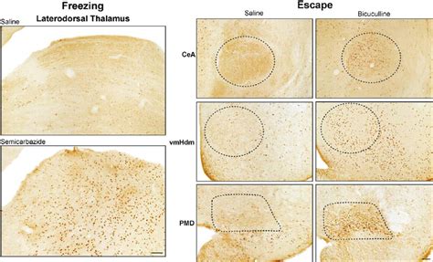 Photomicrographs Of Fos Immunoreactive Cells Dark Dots In Coronal