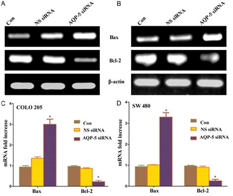 AQP 5 SiRNA Transfection Significantly Increased The MRNA Expression