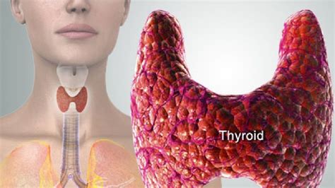 Thyroid: Types of disorders, risk factors, symptoms, tests | Health ...