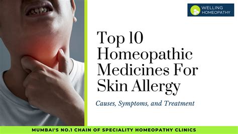 Best 10 Homeopathic Medicines For Skin Allergy Best Homeopathy Doctor