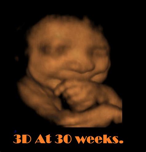 Gallery Cherished Memories 3d 4d Prenatal Ultrasound