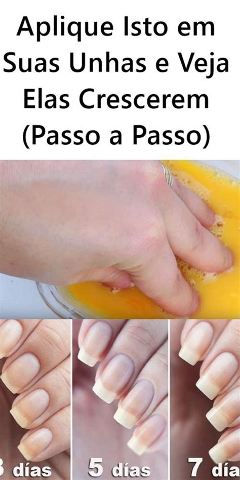 Aplique Isto Em Suas Unhas E Veja Elas Crescerem Passo A Passo