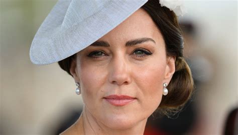 Kate Middleton la situazione è seria Il Palazzo non commenta