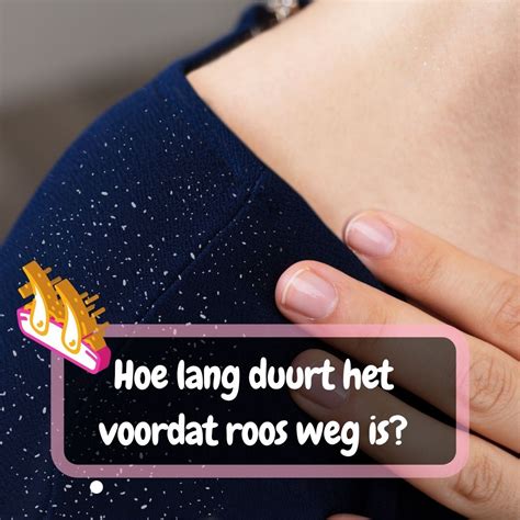 Hoe Lang Duurt Het Voordat Roos Weg Is BeautyGaze