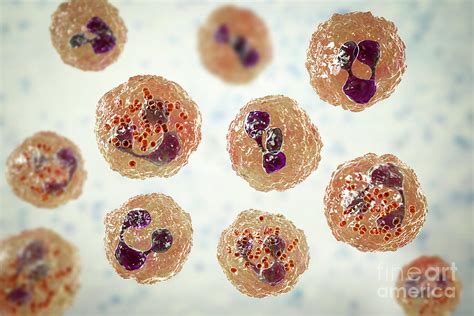 Meningococcal Meningitis 1 By Kateryna Konscience Photo Library