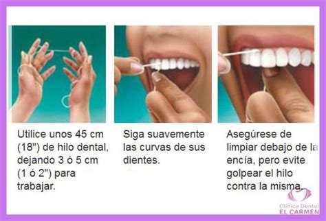 Clínica Dental El Carmen ¿cuál Es El Modo Correcto De Utilizar El Hilo Dental Clínica Dental