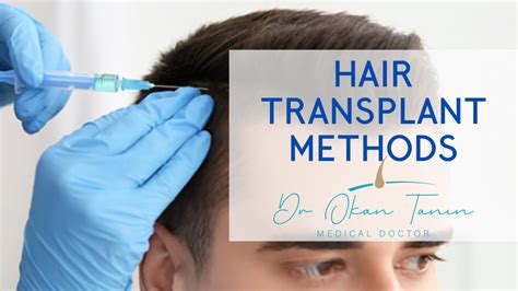 Hair Transplant Methods - Dr. Okan Tanın