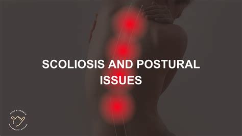 Management Of Scoliosis And Postural Issues Surf And Sports Myotherapy