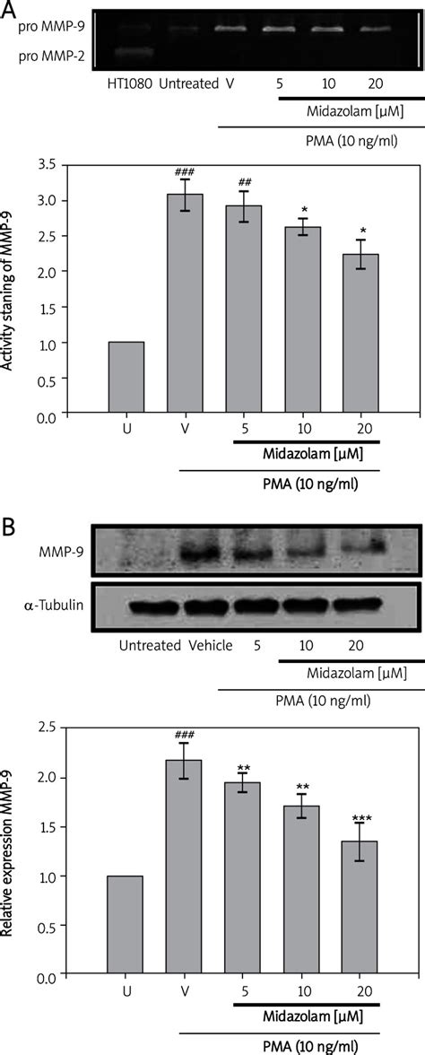 Effects Of Midazolam On Phorbol Myristate Acetate Pma Induced