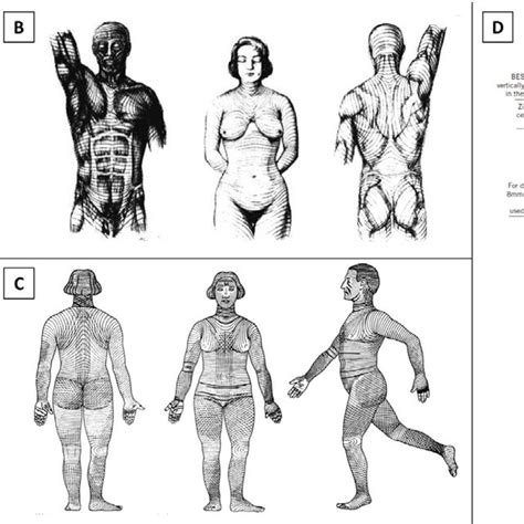 Langer's lines (A) (reprinted from On the anatomy and physiology of the ...