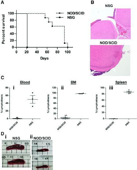 018Z human pre-B-ALL cells induce isolated CNS leukemia in NOD/SCID ...