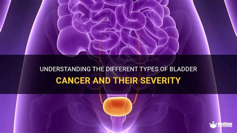 Understanding The Different Types Of Bladder Cancer And Their Severity Medshun