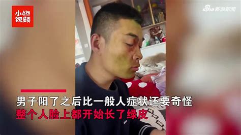 男子阳了后脸都变绿了双眼无神脖子绿到脸网友直呼是“僵尸毒株”手机新浪网