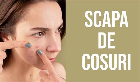 cele mai bune creme de cosuri pareri  recomandri