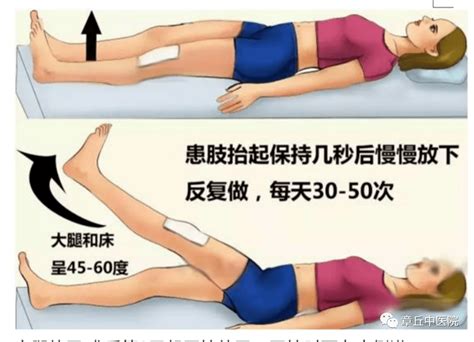 【健康章丘】且行且珍“膝”——膝关节置换术后功能锻炼患者