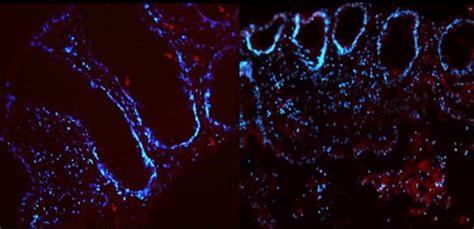 Fluorescence Microscope Pictures Of Small Unilamellar Vesicles In Download Scientific Diagram