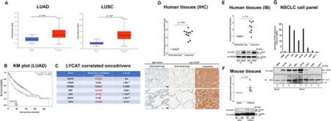 Lysocardiolipin Acyltransferase Regulates Nsclc Cell Proliferation And