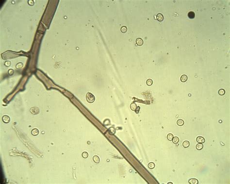 Botrytis cinerea S1 – conidiophores and conidia (600x) | Download Scientific Diagram