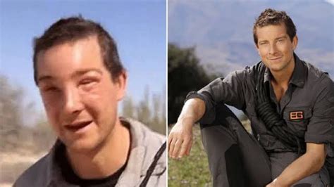 Bear Grylls Looks Unrecognisable After Suffering A Deadly Allergic ...