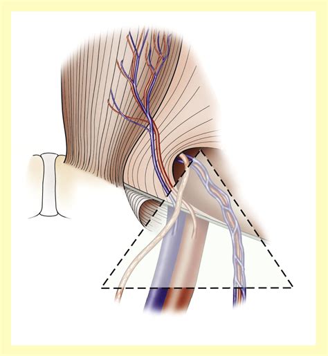 Adult groin hernias - Surgery - Oxford International Edition