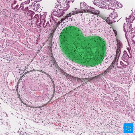 Blood Vessels Histology And Clinical Aspects Kenhub