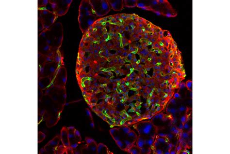 Vegf Receptor B Rabbit Mab Bsa And Azide Free Cell