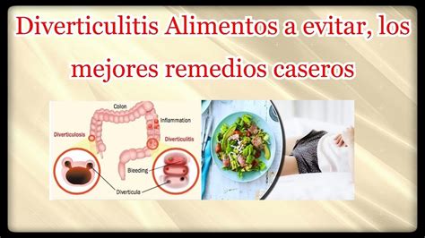 Diverticulitis Alimentos A Evitar Los Mejores Remedios Caseros Youtube