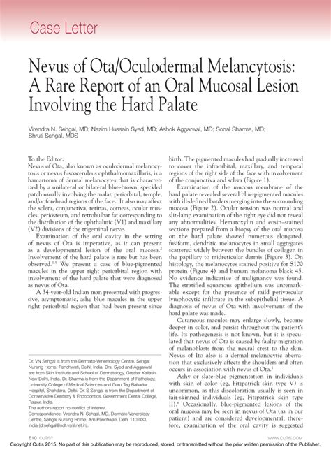 Pdf Nevus Of Otaoculodermal Melancytosis A Rare Report Of An Oral