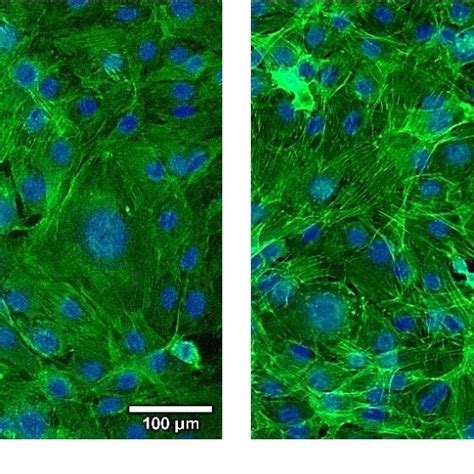 Fluorescence Images Of Actin Filaments Of Mc T E Osteoblasts Cultured