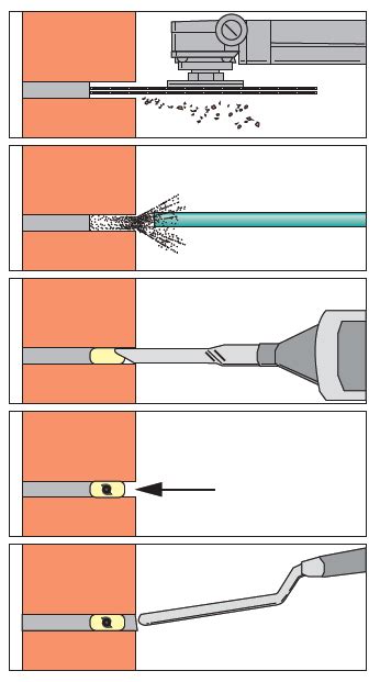 An Introduction To The Helical Wall Tie