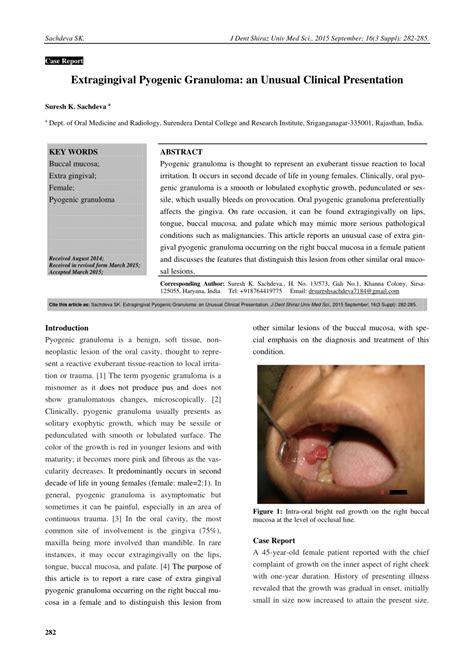 PDF Extragingival Pyogenic Granuloma An Unusual Clinical Presentation