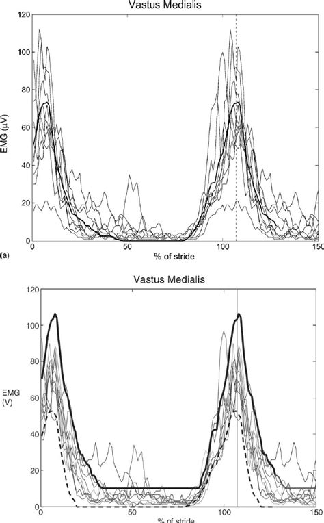 A Average Emg Profiles Of Vastus Medialis Muscle In Normal