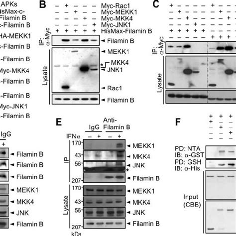 Filamin B Colocalizes With Rac In Membrane Ruffles A Hela Cells