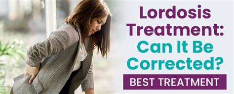 Lordosis Treatment Can It Be Corrected Best Treatment