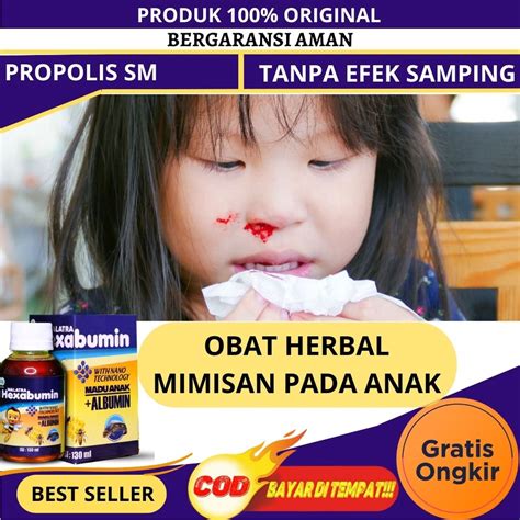 Jual Obat Mimisan Anak Sariawan Keluar Darah Dari Hidung Pusing