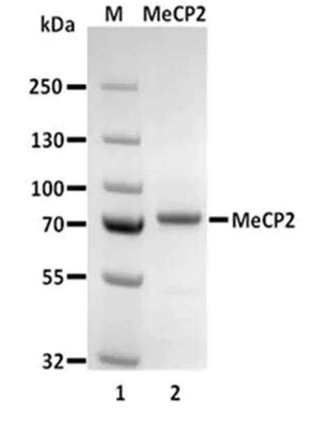 Human Recombinant Mecp Methyl Cpg Binding Protein