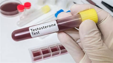 What Are Normal Testosterone Levels For A Man Full Chart And Guide