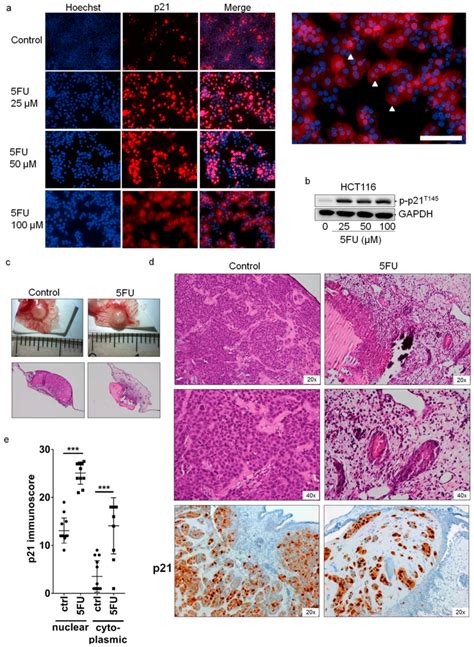 Localization Of P21 In 5FU Resistant HCT116 Cells A HCT116 Cells