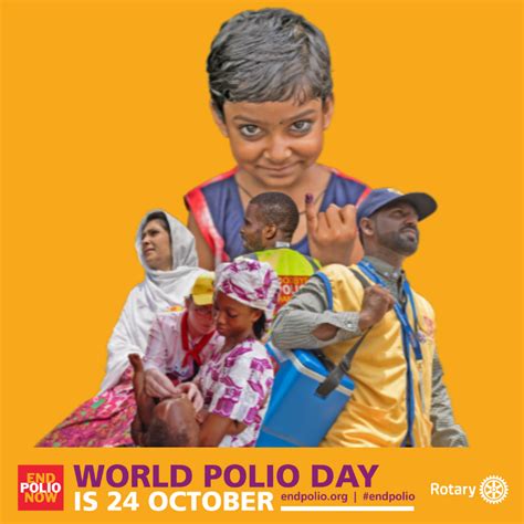 World Polio Day October 24 2021 Rotary Club Of Castro Valley