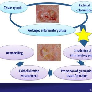 PRP mechanism of action - Elena Conde