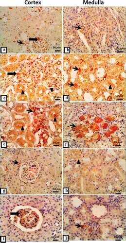 Full Article L Thyroxine Ameliorates Renal Function In