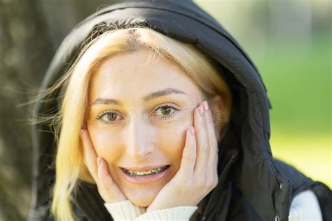 Blonde Woman Wearing Braces And Holding Her Face With Hands Stock Image Image Of Happy