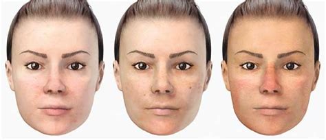 insights  skin appearance  measurement skyn