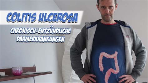 Colitis Ulcerosa Krankheitslehre Pflege Kanal YouTube