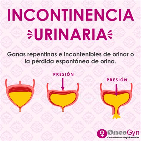 Incontinencia Urinaria Chequeos Ginecológicos Oncogyn