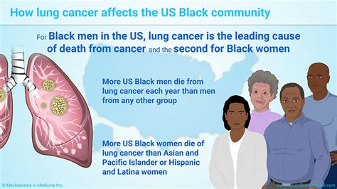 Slide Show Lung Cancer Clinical Trials And The Us Black Community