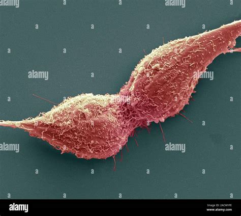 Dividing Prostate Cancer Cells Scanning Electron Micrograph Sem